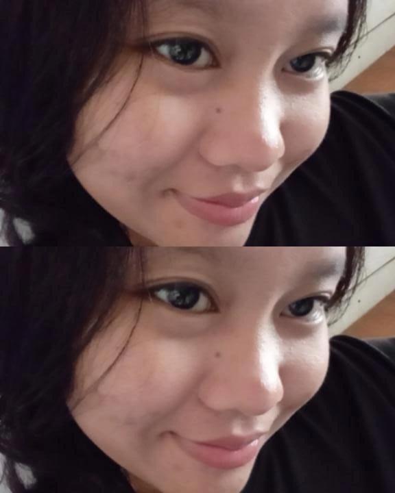 Winci